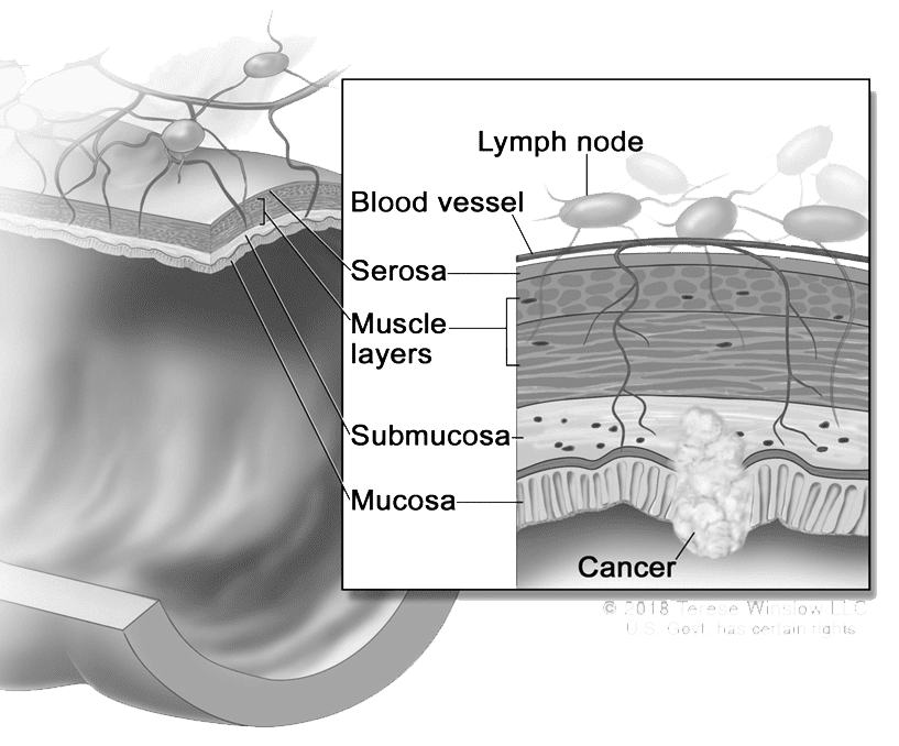 guide image