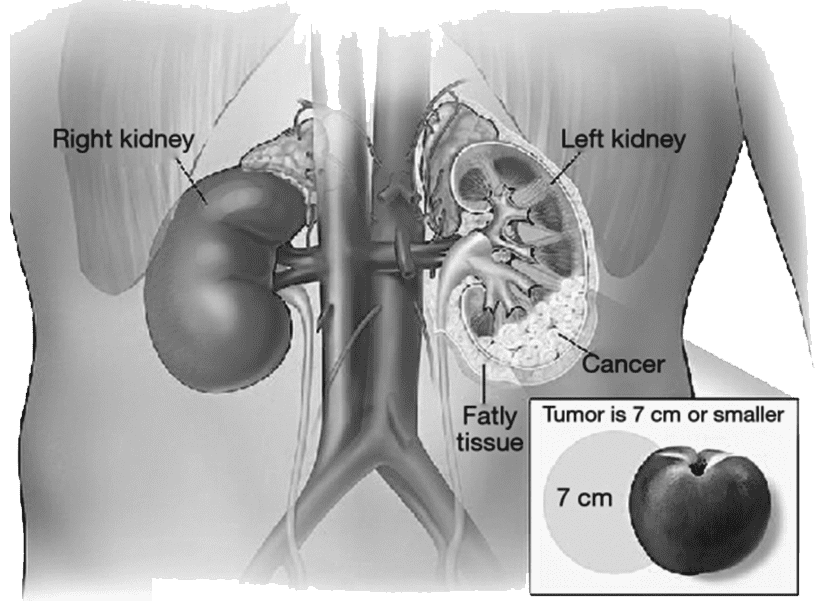 guide image