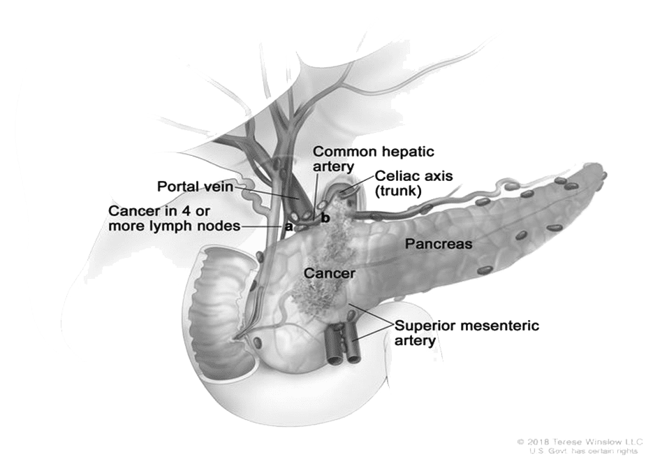 guide image