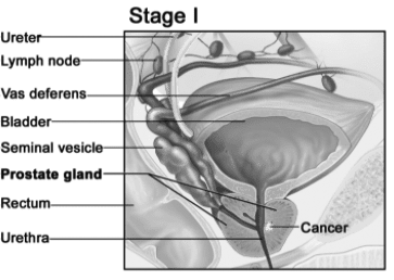 guide image