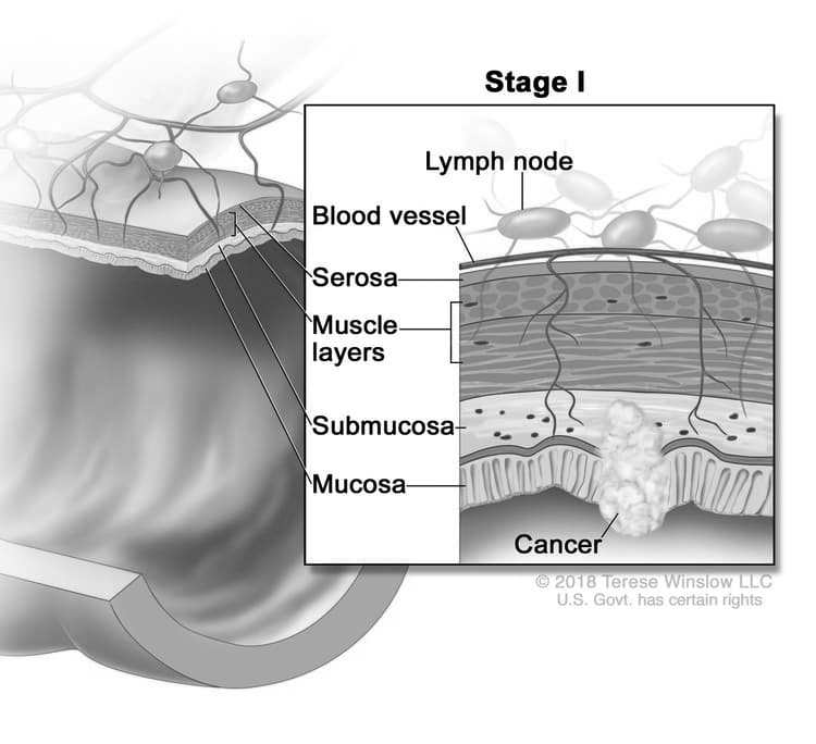 guide image