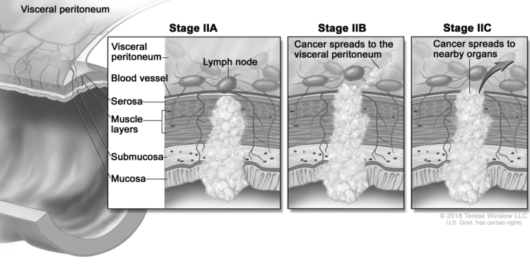 guide image